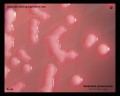 klebsiella pneumoniae growing on MacConkey